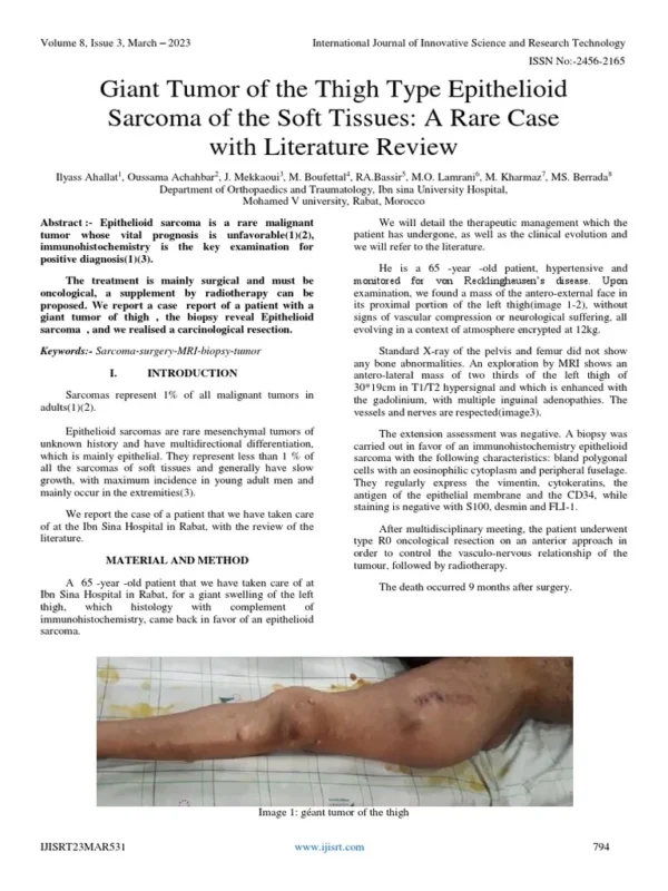 4902990812020_giant-tissues-150s